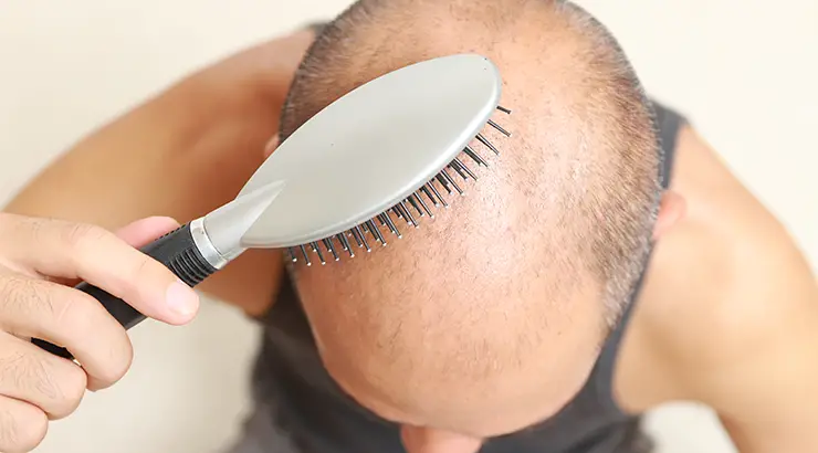 Kako spriječiti ispadanje kose?