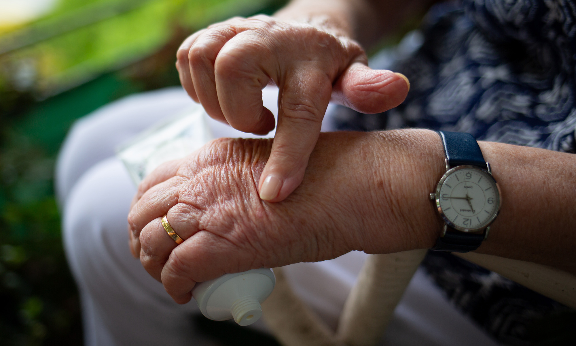 liječenje artritisa umirovljenika